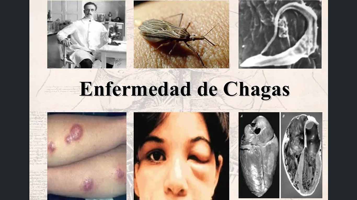 enfermedad-de-chagas